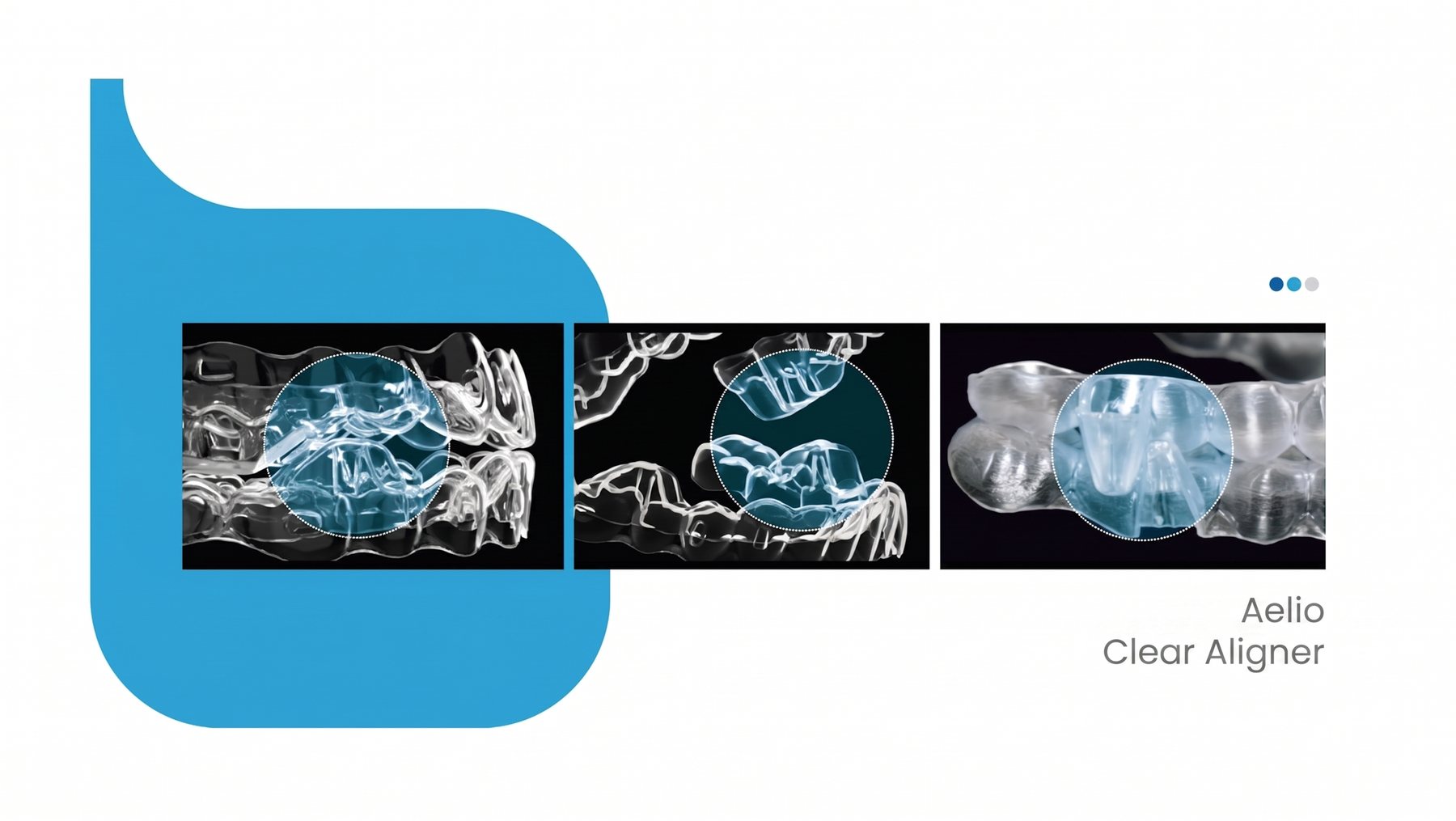 Aelio clear aligner